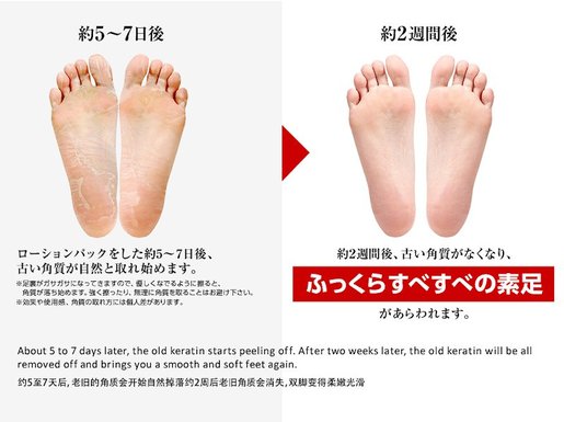Ashiura Ran Run Horse Oil Foot Peeling 1 Pair